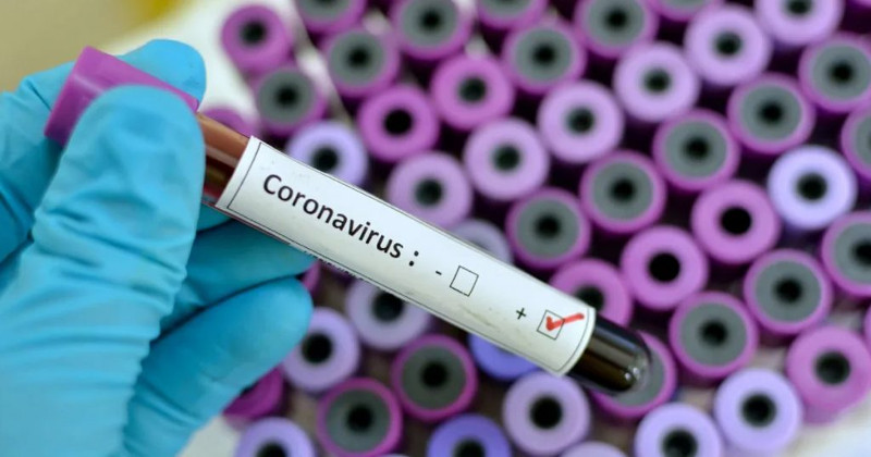 coronavirus eprubeta 1024x538 1