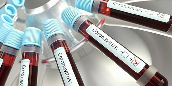 teste coronavirus