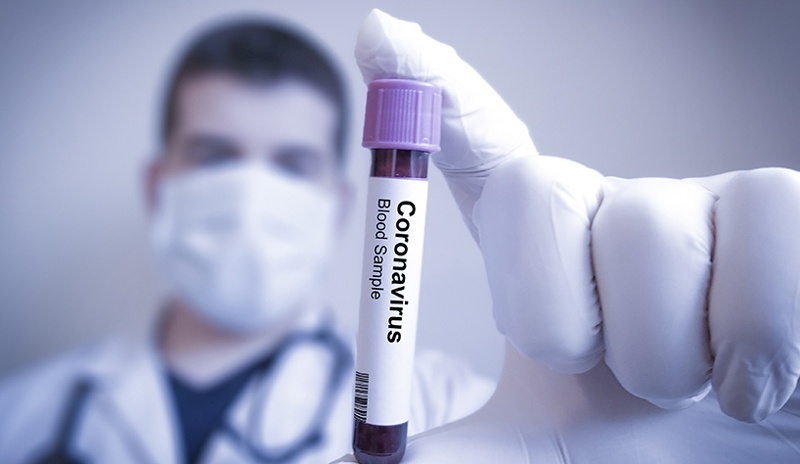 25cum gestionam potentialele cazuri de infectie cu noul coronavirus